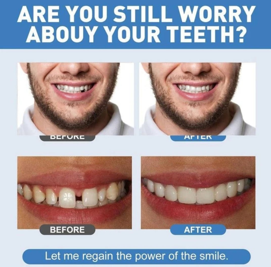 "Regain Your Perfect Smile in Minutes – No Dentist Needed!"